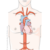 Afectiunile cardiace