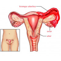 Anexita si metroanexita