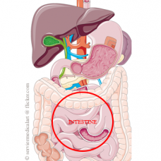 Bolile intestinelor Bolile intestinelor