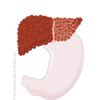 Hepatita acuta si cronica Hepatita acuta si cronica