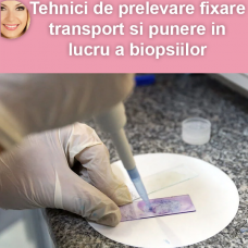 Tehnici de prelevare, fixare, transport şi punere în lucru a biopsiilor şi pieselor chirurgicale