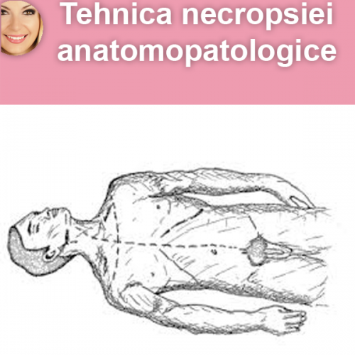 Tehnica necropsiei anatomopatologice